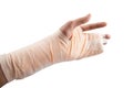 Woman hand bone broken from accident emergency isolate