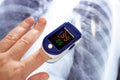 Woman hand with medical fingertip pulse oximeter tool for oxygen saturation check during covid virus desease. SpO2 monitoring