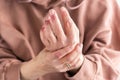 Woman hands with atopic dermatitis, eczema, allergy reaction on skin Royalty Free Stock Photo