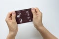 Woman hands holding picture of ultrasound of embryo on white background