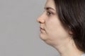 The woman has a double chin. Treatment, chin reshaping, fat removal, lifting. Place for text copy space. Royalty Free Stock Photo