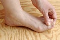 A woman has pain on her feet. Nail fungus on the feet Royalty Free Stock Photo