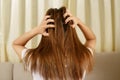 A woman has problems with hair and scalp,she has dandruff from allergic reactions to shampoos.