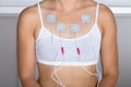 Woman Having Electrotherapy On Chest Royalty Free Stock Photo