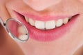 Woman having her dental checkup