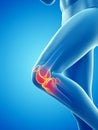 A woman having a painful knee Royalty Free Stock Photo