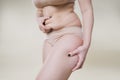 Woman holding fold of skin, cellulite on female body, beige background Royalty Free Stock Photo