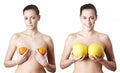 Woman Holding Satsumas And Melons To Illustrate Breast Enlargement Surgery Royalty Free Stock Photo