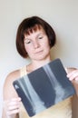 Woman holding x-ray image Royalty Free Stock Photo