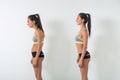 Woman with impaired posture position defect scoliosis and ideal bearing