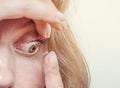 Woman inserts a contact lens into the eye. Close-up, domestic scene. Optics, Vision, Optical Instruments Royalty Free Stock Photo