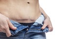 A woman in jeans shows a large scar on her stomach. Consequences of caesarean section and abdominal surgery. Close-up. White