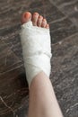 Woman leg in white medical bandages, the result of trauma or surgery, with iodine spots and peach pedicure.