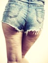 Woman legs with cellulite skin Royalty Free Stock Photo