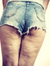 Woman legs with cellulite skin Royalty Free Stock Photo