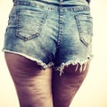 Woman legs with cellulite skin Royalty Free Stock Photo