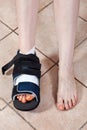 Woman legs, one in bandage and orthopedic boot after trauma or surgery, with iodine spots. The result of using tigh shoes, deform