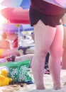 Woman legs with red sunburn skin on the beach