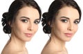 Woman before and after lip correction procedure on background Royalty Free Stock Photo