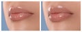 Woman before and after lip correction procedure. Banner design Royalty Free Stock Photo