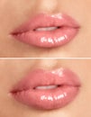 Woman before and after lip correction procedure Royalty Free Stock Photo