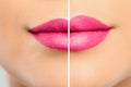 Woman before and after lip correction procedure Royalty Free Stock Photo