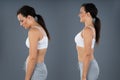 Woman With Lordosis And Normal Curvature Royalty Free Stock Photo