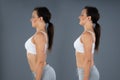 Woman With Lordosis And Normal Curvature Royalty Free Stock Photo