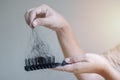 Woman losing hair on hairbrush in hand. Hair loss problem concept Royalty Free Stock Photo