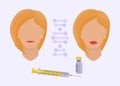 Woman makes procedure of beauty injection for lip augmentation. Lips before and after hyaluronic acid lip filler Royalty Free Stock Photo