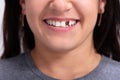 Woman With Missing Tooth