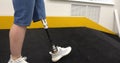 A woman with a modern robotic prosthetic leg is working out in the gym. Physiotherapy rehabilitation that allows a