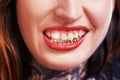 Woman, mouth and smile with gold teeth to shine for glamour and wealth with cosmetics. Closeup, dental jewelry and Royalty Free Stock Photo