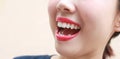 Woman mouth smile with great teeth on background. Royalty Free Stock Photo