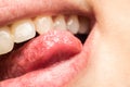 Woman Natural Lips And Tongue Macro