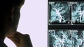 Woman neurologist examining xray of blood vessels, vascular occlusion, treatment