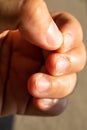 Woman nibbling  her nails, Close up & Macro shot, Selective focus, Asian body skin part, Healthcare concept Royalty Free Stock Photo