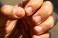 Woman nibbling her nails, Close up & Macro shot, Selective focus, Asian body skin part, Healthcare concept Royalty Free Stock Photo