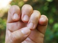 Woman nibbling nails, Close up and macro shot, Selective focus, Asian body Language concept Royalty Free Stock Photo