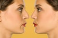 Woman before and after nose surgery