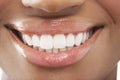 Woman With Perfect White Teeth Royalty Free Stock Photo