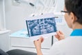 Woman periodontist examining x-ray image of patient jaw