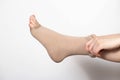 A woman puts on compression stockings for legs with varicose veins. Pain and swelling in the legs, phlebology. White