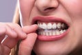 Woman Putting Transparent Aligner In Teeth