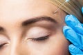 Woman receiving botox injection on her forehead Royalty Free Stock Photo