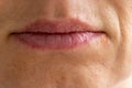 Senior woman`s corner of mouth with Herpes Labialis Royalty Free Stock Photo