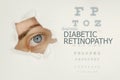 Woman`s eye looking trough teared hole in paper, eye test with words Diabetic Retinopathy on right. Royalty Free Stock Photo