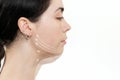 A woman`s face in profile, with white surgical arrows on the chin. White background. Copy space. The concept of plastic surgery Royalty Free Stock Photo