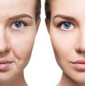 Woman`s face before and after rejuvenation.