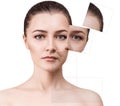 Woman`s face before and after rejuvenation. Royalty Free Stock Photo